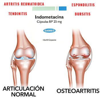 Indometacina de Saimed 100 Cápsulas alivio eficaz para tu bienestar